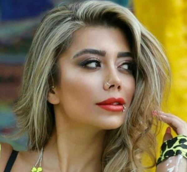 عکس الناز قاسمی قبل از عمل