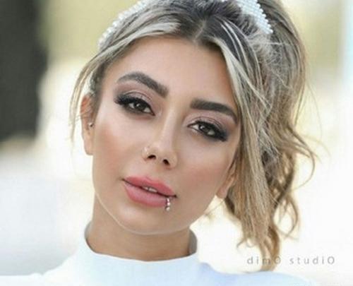 عکس الناز قاسمی قبل از عمل