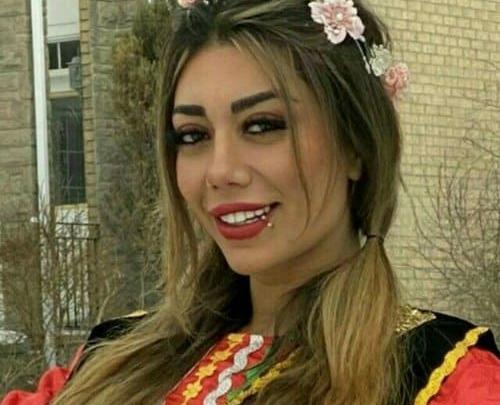 عکس الناز قاسمی قبل از عمل