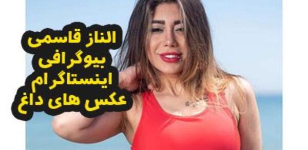 عکس الناز قاسمی قبل از عمل