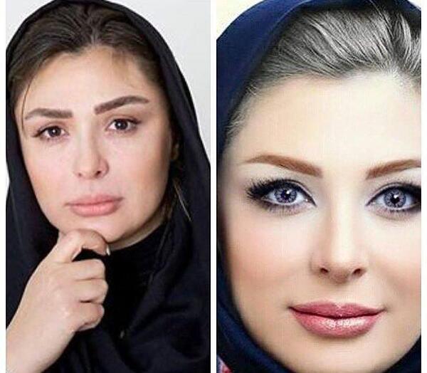 عکس قبل نیوشا