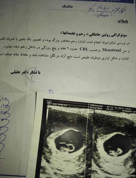 عکس بارداری نی نی سایت