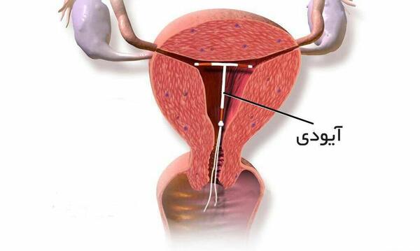 عکس ضد بارداری