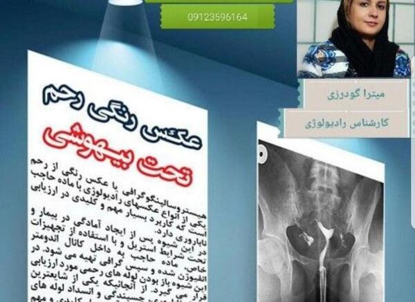 عکس رنگی و بارداری سریع نی نی سایت