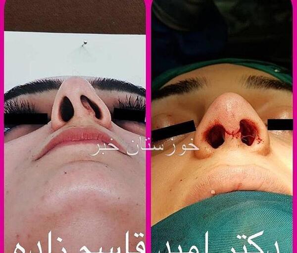 عکس امید قاسم زاده