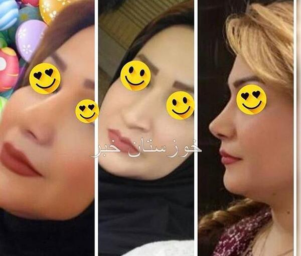 عکس امید قاسم زاده