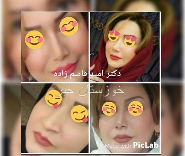 عکس امید قاسم زاده