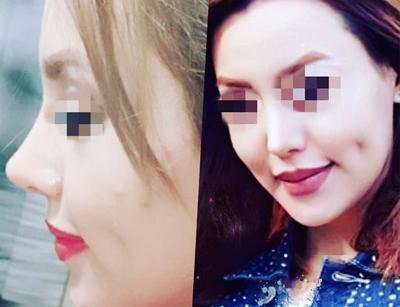 عکس امید قاسم زاده