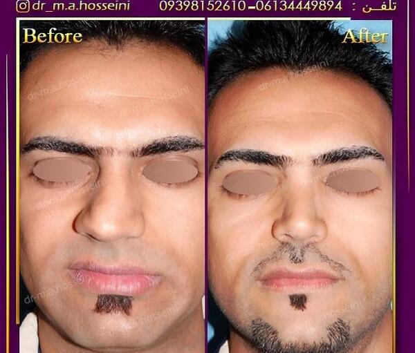 عکس امید قاسم زاده
