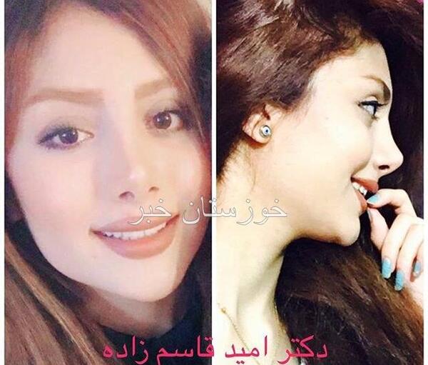 عکس امید قاسم زاده