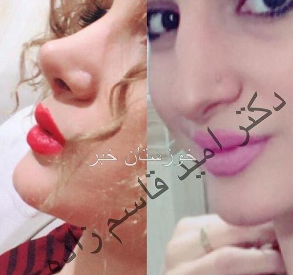 عکس امید قاسم زاده