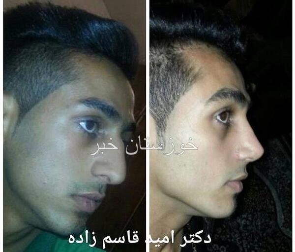 عکس امید قاسم زاده