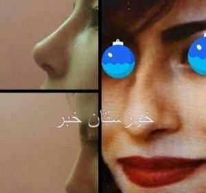 عکس امید قاسم زاده