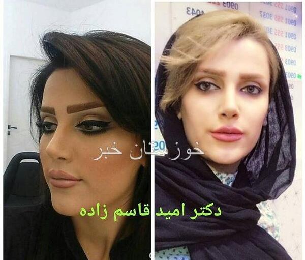 عکس امید قاسم زاده