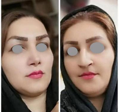 عکس امید قاسم زاده