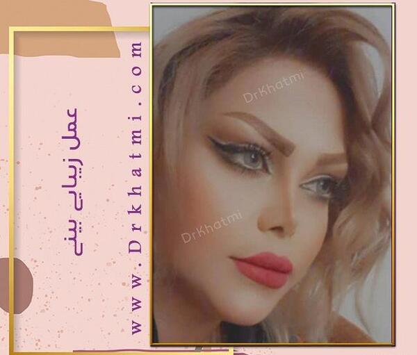 عکس امید قاسم زاده