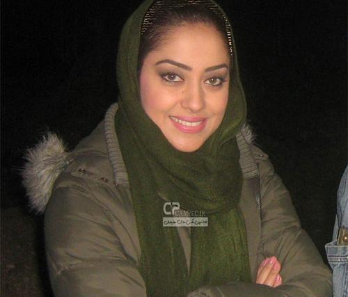 عکس بهاره کیان افشار قبل از عمل