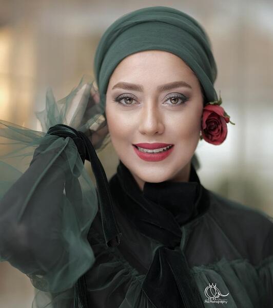 عکس بهاره کیان افشار قبل از عمل