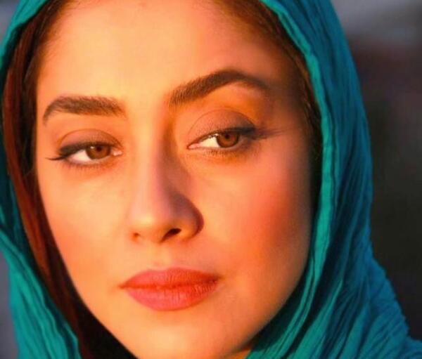 عکس بهاره کیان افشار قبل از عمل