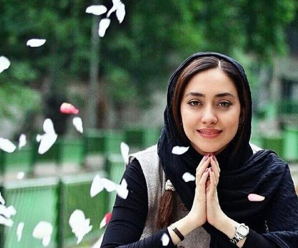 عکس بهاره کیان افشار قبل از عمل