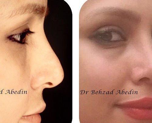 عکس بهزاد عابدین
