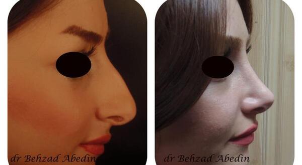عکس بهزاد عابدین