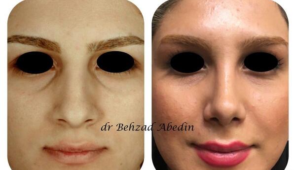 عکس بهزاد عابدین