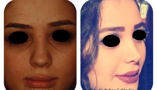 عکس بهزاد عابدین