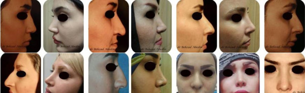 عکس بهزاد عابدین