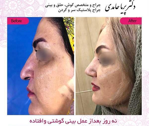 عکس پریا حامدی