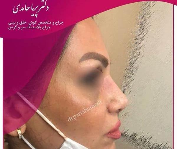 عکس پریا حامدی