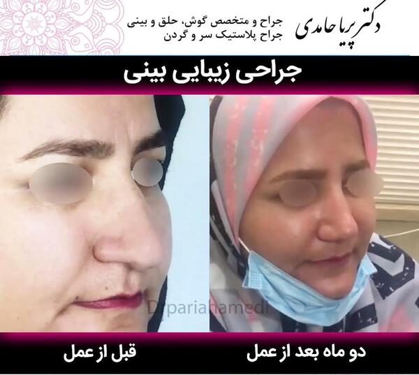 عکس پریا حامدی