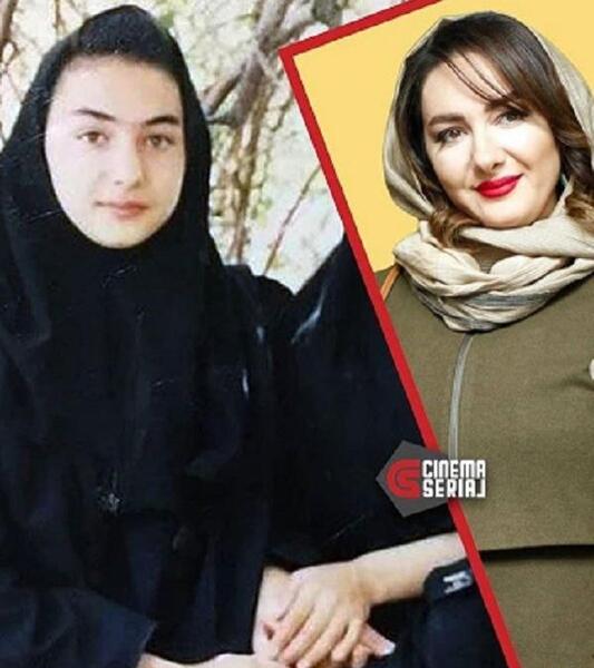 عکس هانیه توسلی قبل از عمل