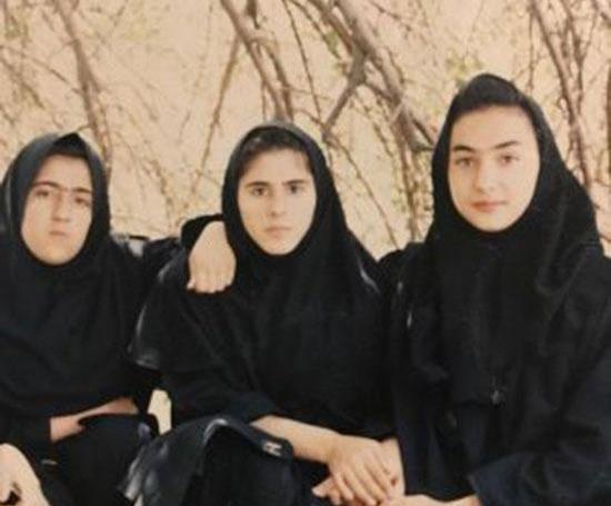 عکس هانیه توسلی قبل از عمل