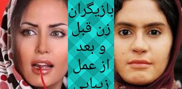 عکس هانیه توسلی قبل از عمل