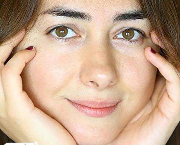 عکس هانیه توسلی قبل از عمل