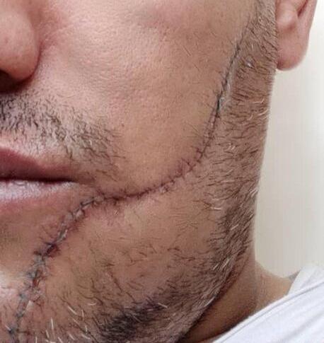 عکس حمید تبری