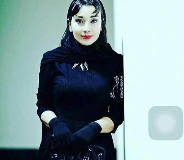 عکس خاطره حاتمی قبل از عمل