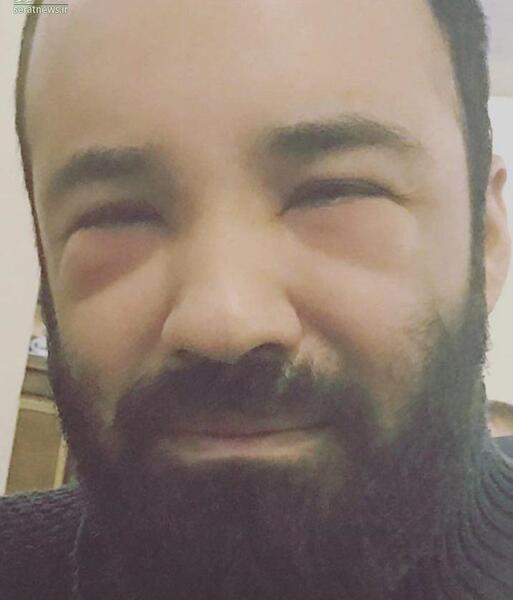 عکس رضا هلالی