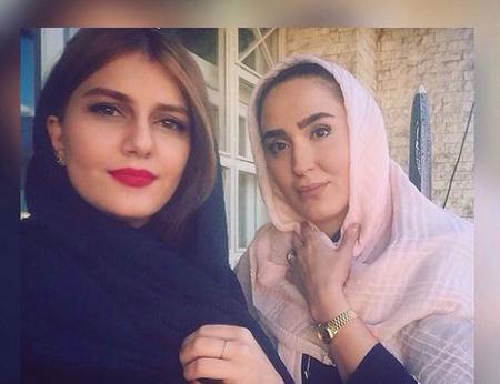 عکس زهره فکور صبور قبل از عمل