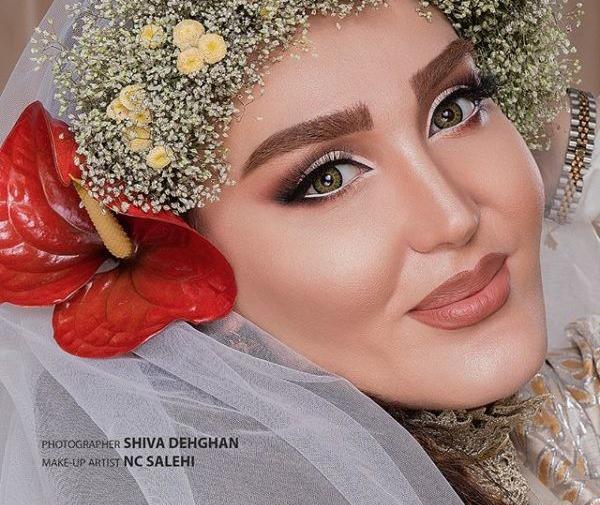 عکس زهره فکور صبور قبل از عمل