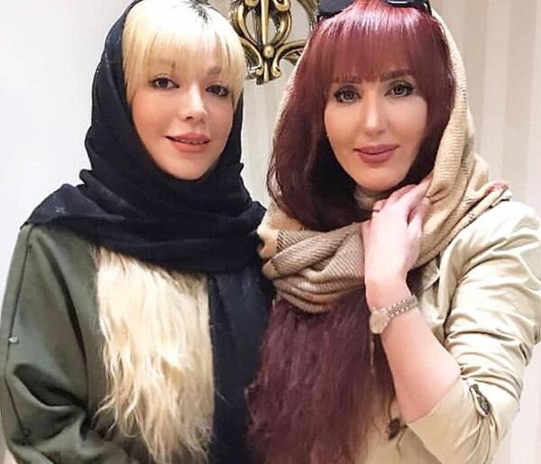 عکس زهره فکور صبور قبل از عمل