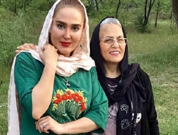 عکس زهره فکور صبور قبل از عمل
