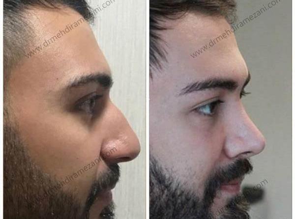عکس پسر دماغ عملی خوشگل