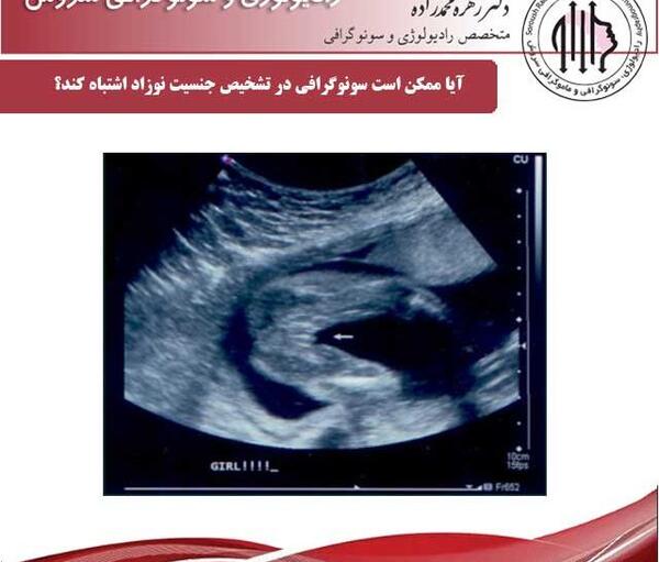 عکس سونوگرافی nt پسر