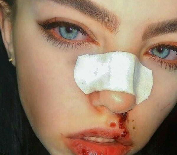 عکس دخترونه ویسگون شاخ