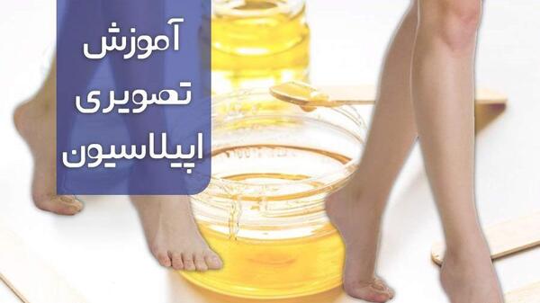 عکس اپیلاسیون