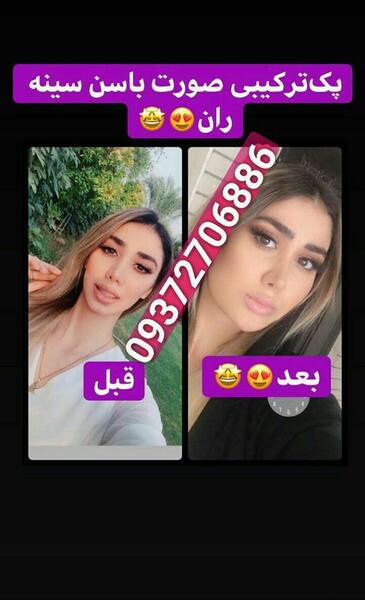 عکس قرص اپل