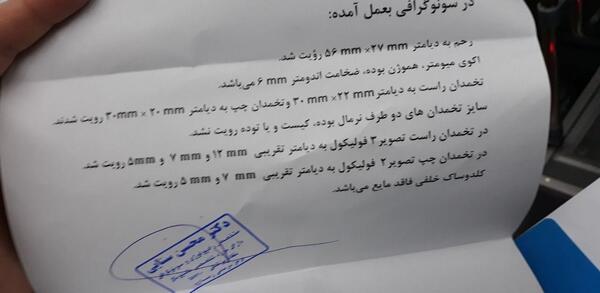 عکس آمپول هاش ام جی