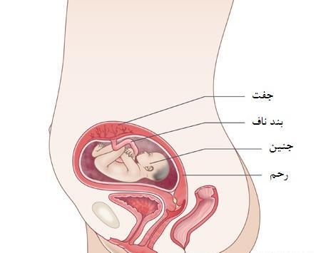 عکس بیست و دو هفتگی جنین